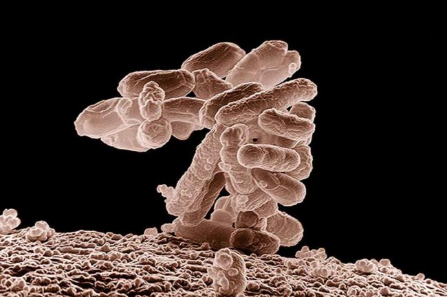 e-coli-usda-ars.jpg